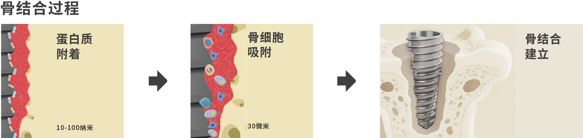 骨结合过程.png
